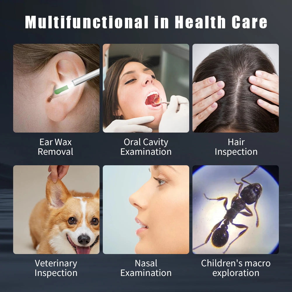 Wireless HD NK3 Pro Earwax Cleaning Kit