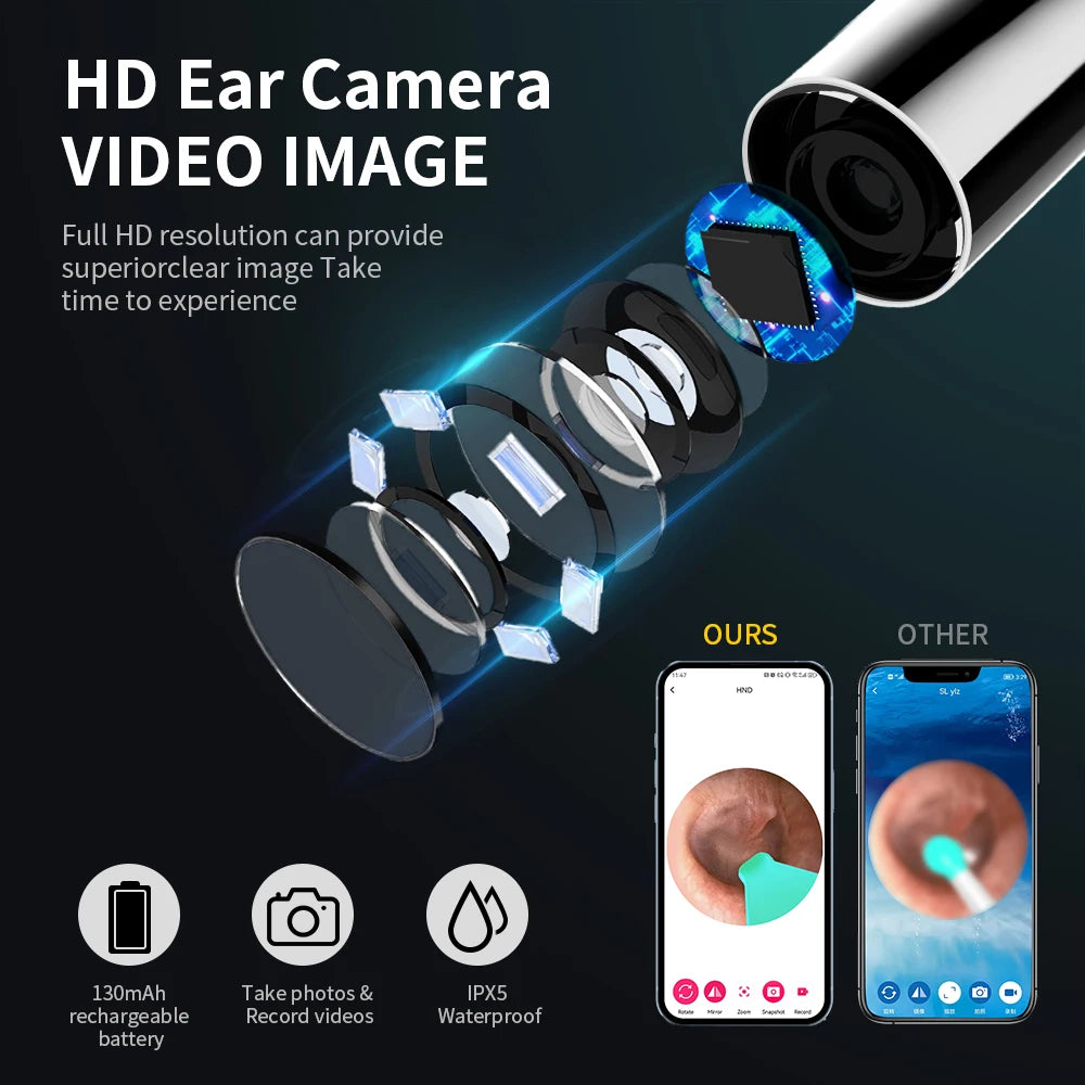 Wireless HD NK3 Pro Earwax Cleaning Kit